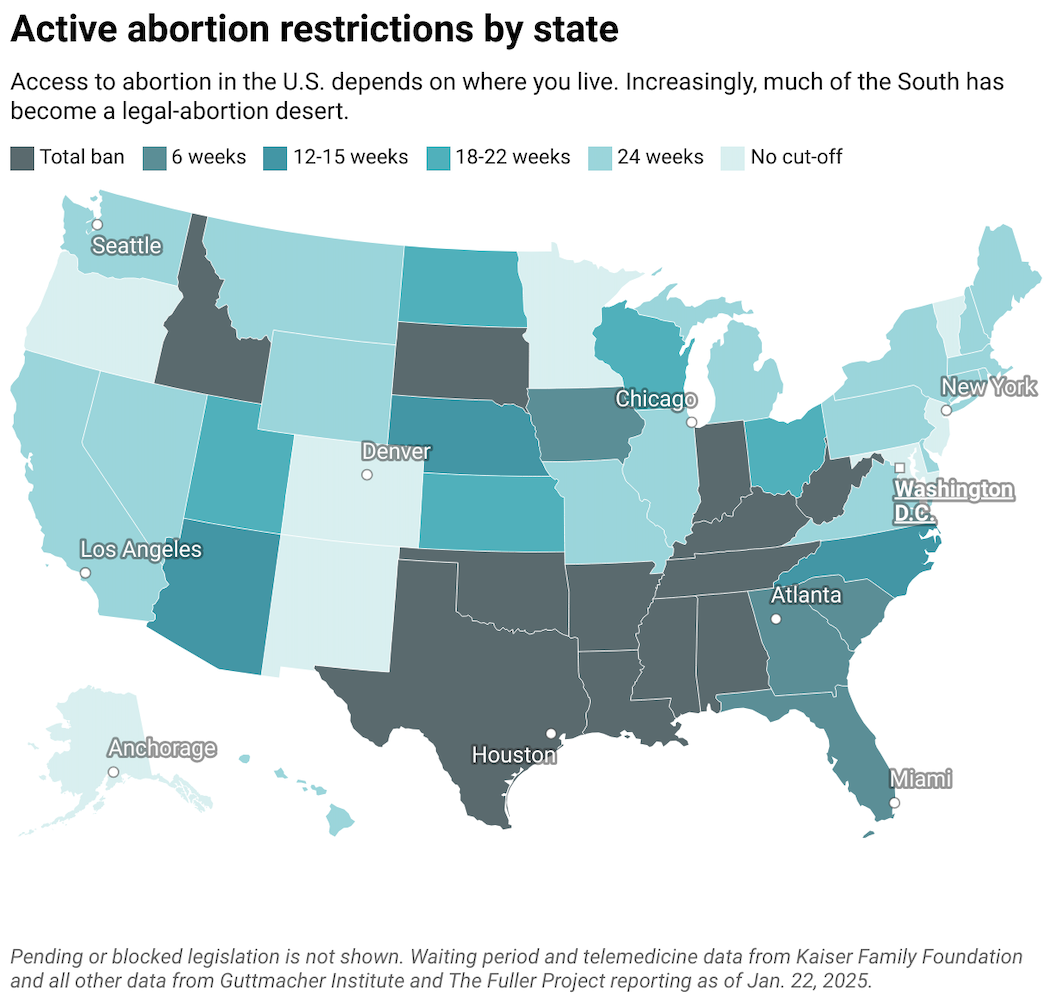 How major abortion laws compare, state by state | Fuller